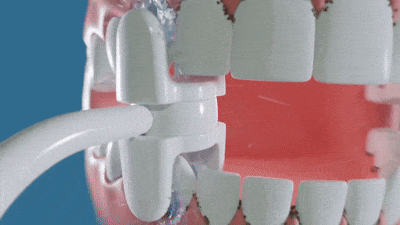 Magic Flosser - Walmart Shoppers Say the Magic Flosser Gets in the Nooks and Crannies