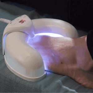FungaBeam - Fights Nail Fungus Symptoms with Laser