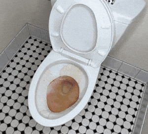 X-All Toilet Cleaner - Clean Your Toilet Without Scrubbing or Bending Over
